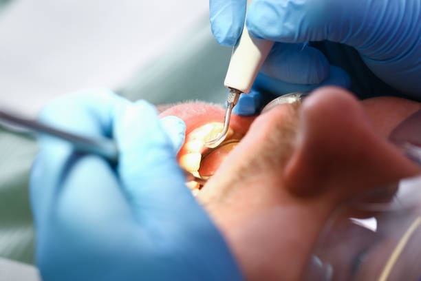 Best Emergency Dentist for Knocked-Out Tooth in Wake Village, TX