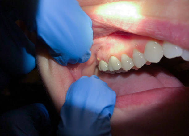 Best 24-Hour Emergency Dentist in Wake Village, TX
